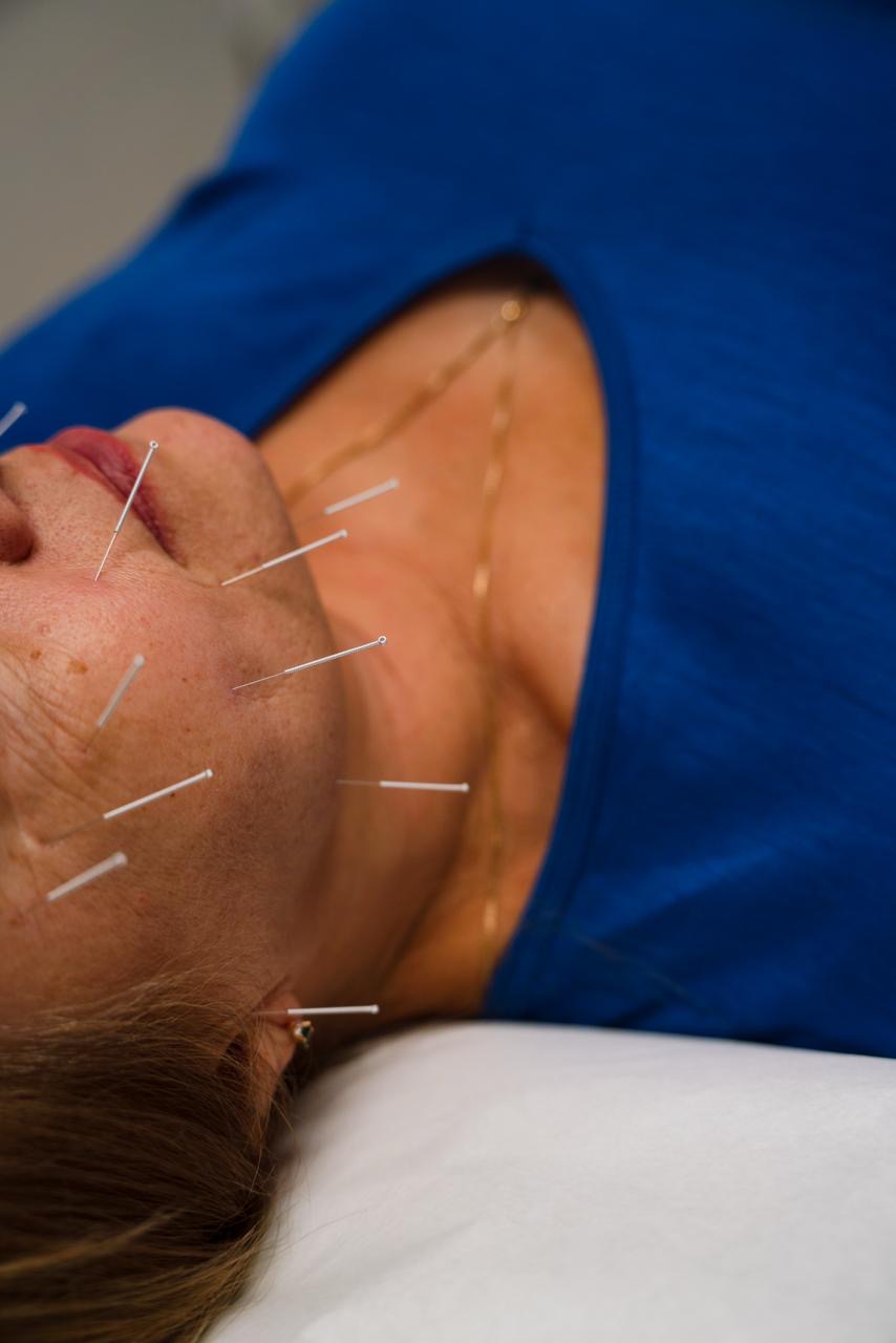 Accupuncture in Edmonton - experienced therapist